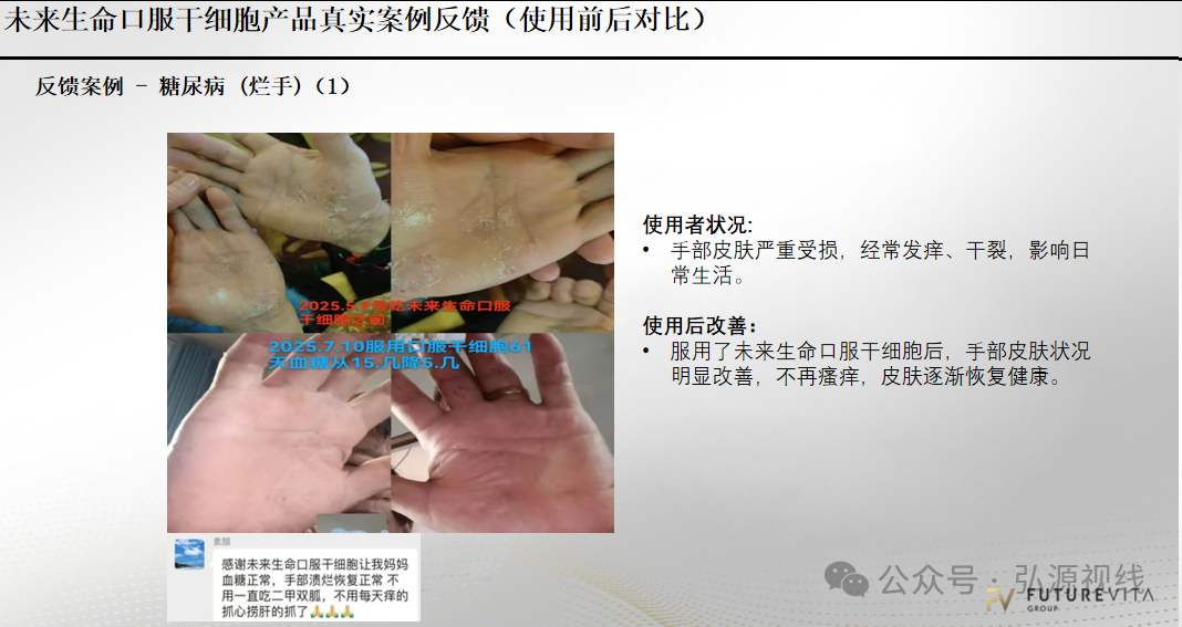 “Futurevita未来生命”：包装成海外健康项目，能治疗各种疾病？